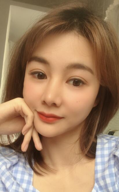 廈門(mén)華美名媛整形美容醫(yī)院做雙眼皮手術(shù)后的恢復(fù)情況