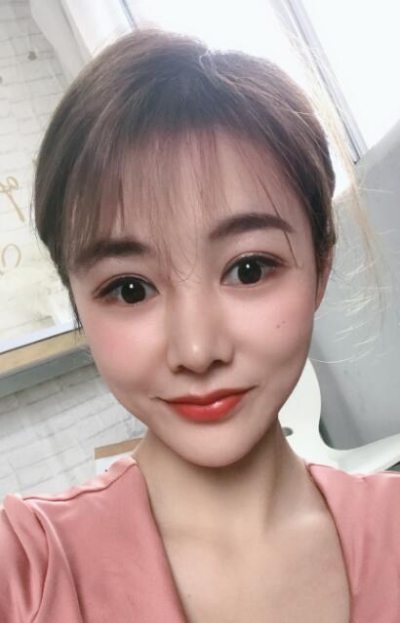 廈門(mén)華美名媛整形美容醫(yī)院做雙眼皮手術(shù)后的明亮雙眼