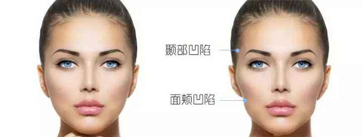 熱瑪吉做一次可以保持多久？熱瑪吉的原理和功效