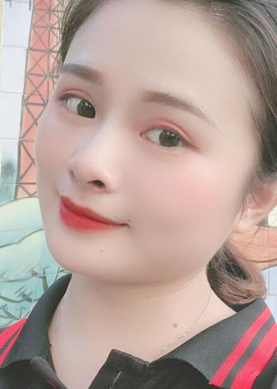 長春中妍醫(yī)療美容醫(yī)院趙勝友雙眼皮案例效果分享