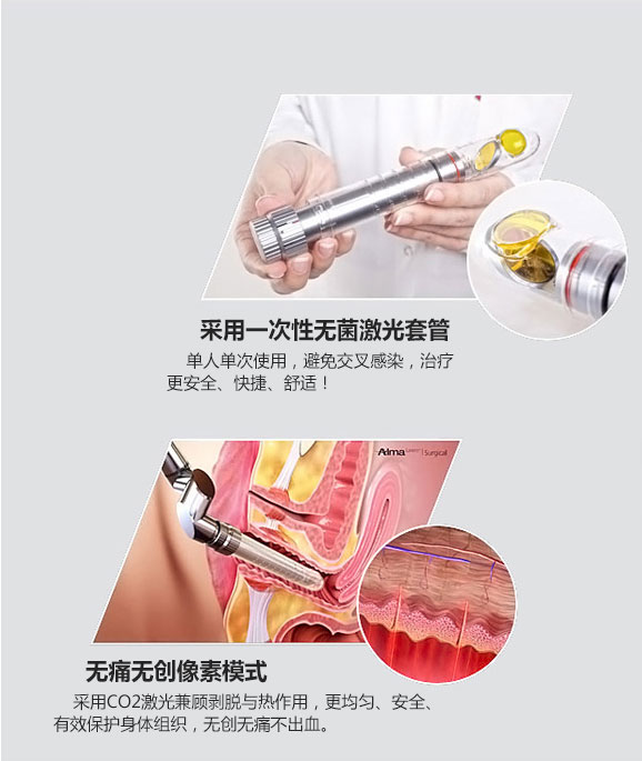 成都愛(ài)爾麗整形激光緊縮陰道怎么樣？激光緊縮陰道注意什么？