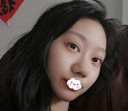 上海伊美爾港華做的3w的鼻子，你們說值不值
