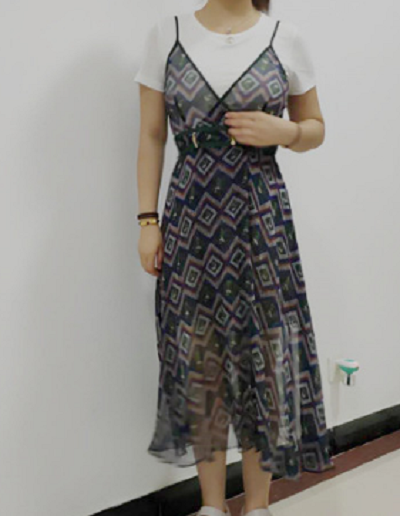 廈門(mén)海峽整形美容醫(yī)院做腰腹吸脂拆完線(xiàn)后