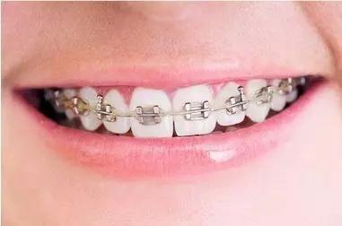 常州瀚景口腔牙齒拋光怎么樣？牙齒拋光有什么作用？
