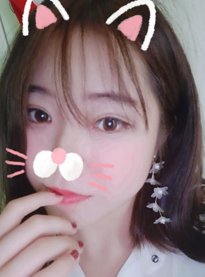 北京東方瑞麗醫(yī)療美容門診部秦繼峰做雙眼皮案例效果分享